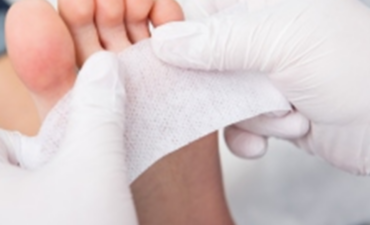 Pés diabéticos, protocolo de cuidados.