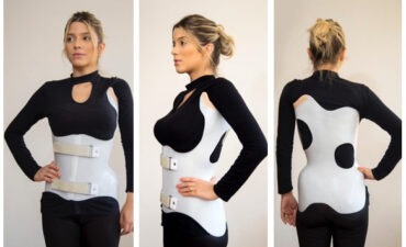 Colete 3D para Escoliose, o suporte mais avançado ao tratamento.