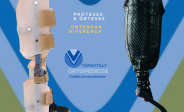 A Diferença Entre Próteses e Órteses