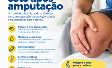 Cuidados com o coto após amputação: checklist completo
